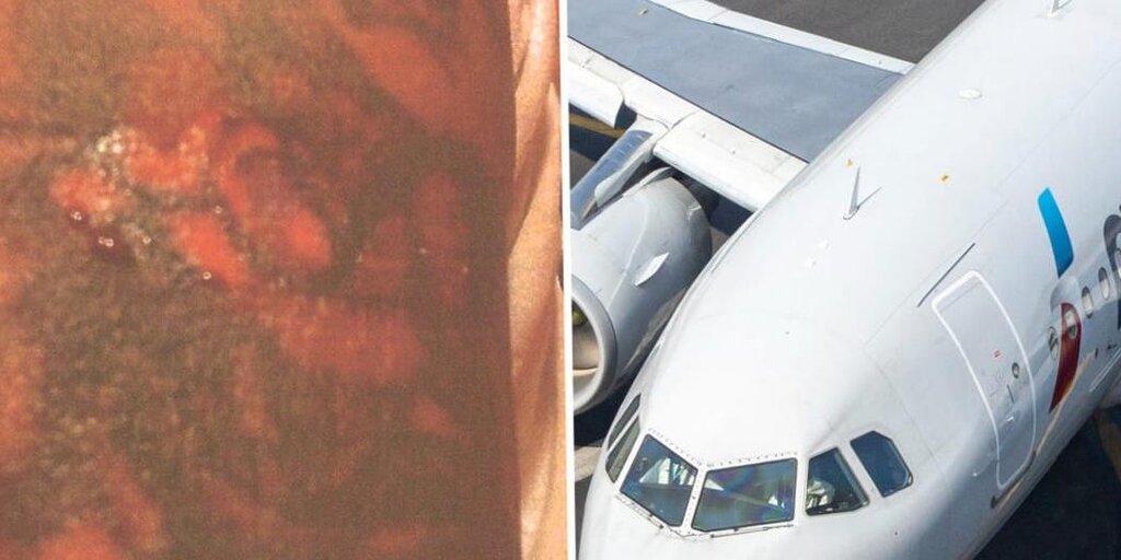 Un homme poursuit American Airlines pour avoir été « échaudé » par du café chaud Un homme poursuit American Airlines pour avoir été « échaudé » par du café chaud