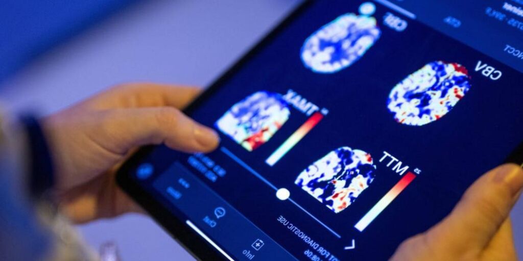 L’IA aide l’industrie de la santé, comment les médecins choisissent les médicaments et les traitements