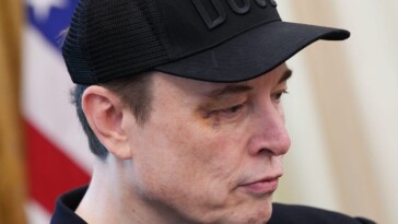 Elon Musk raconte l’histoire derrière son œil au beurre noir