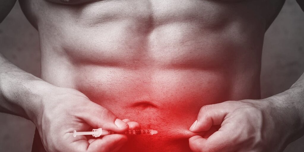 Les injections peu connues que les gens utilisent pour développer leurs muscles cet été, y compris le fameux ‘Wolverine’ Les injections peu connues que les gens utilisent pour développer leurs muscles cet été, y compris le fameux ‘Wolverine’
