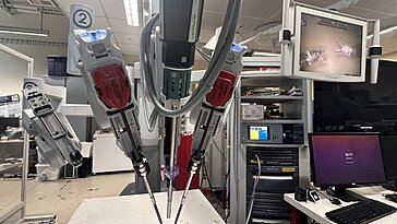Ablation autonome de la vésicule biliaire : une avancée en chirurgie robotique