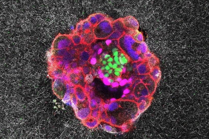 Une vidéo incroyable montre la première implantation d’un embryon humain en temps réel