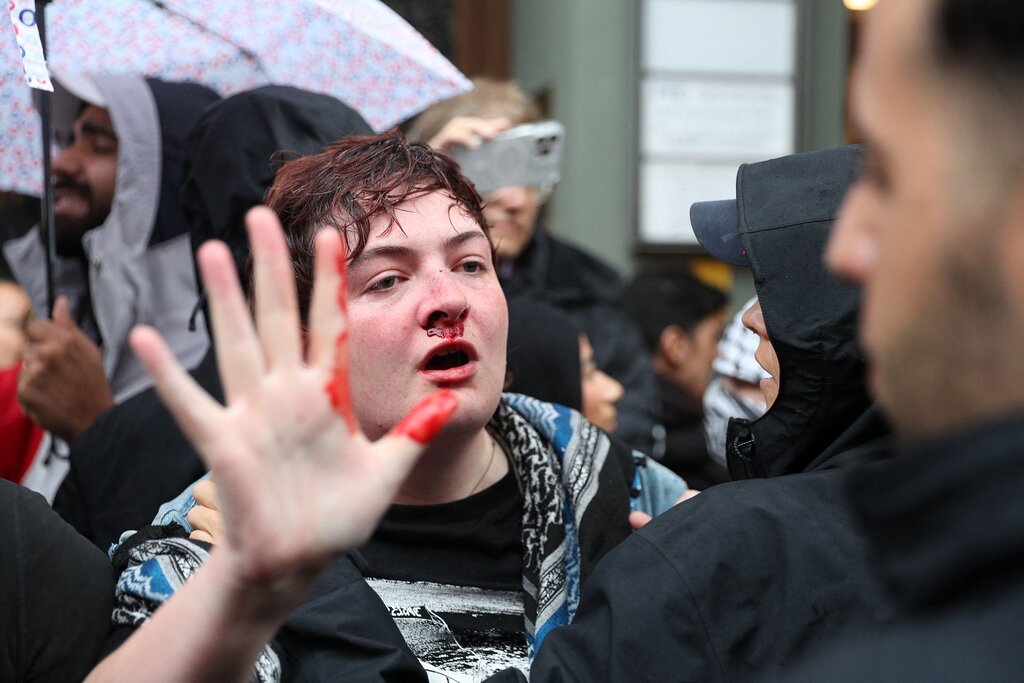 Une enquête a débuté après qu’une militante irlandaise ait été agressée par un policier en manifestation Une enquête a débuté après qu’une militante irlandaise ait été agressée par un policier en manifestation