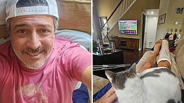 En jouant au pickleball, je me suis blessé au tendon d’Achille et j’ai consulté une célébrité
